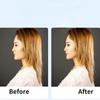 The Stretching Straps For Lift The Eyes And Eyebrows Bb Clip Elastic Band Adjustable Rubber For Hair Anti-Wrinkle Face Tapes