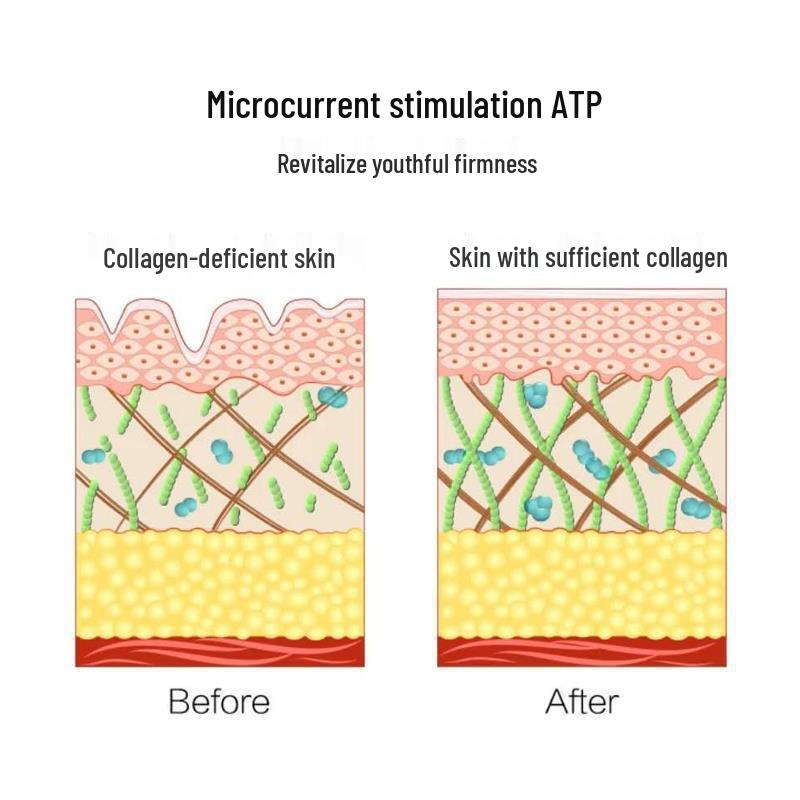 Cross-border RF Neck & V-Face Lifting Roller for Skin Rejuvenation & Microcurrent Beauty
