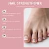 Nail Care Repairing Broken Stratum Corneum, Stratum Corneum Oil, Dry Stratum Corneum Care,20ml,