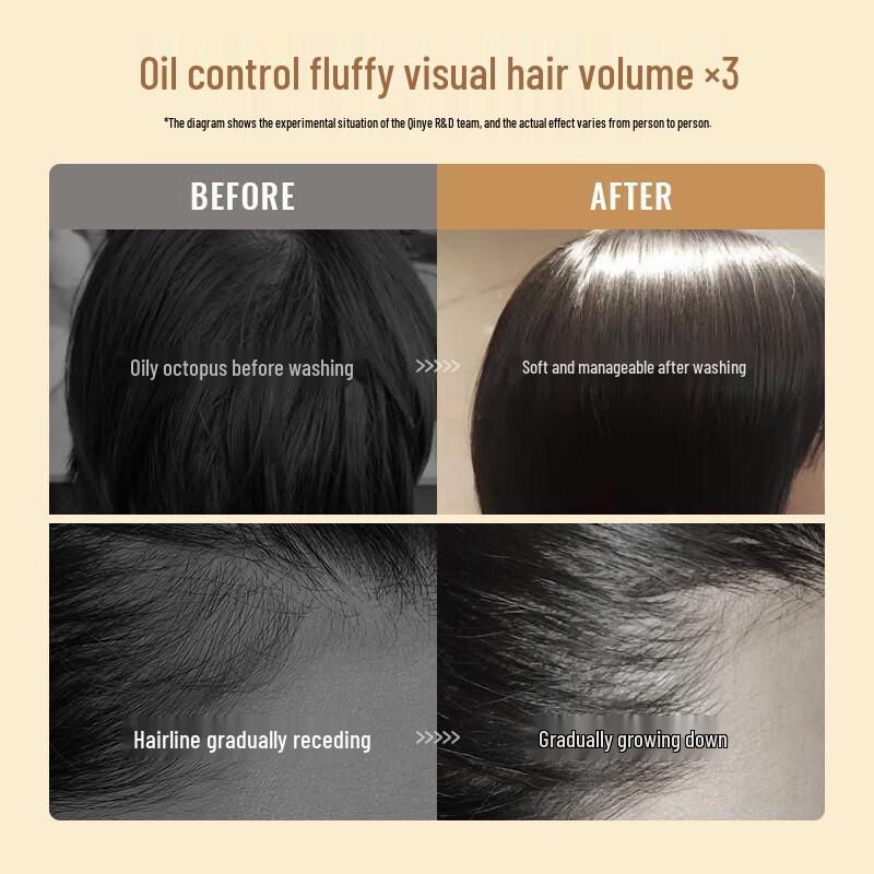 Qinyie Ginger Anti-Hair Loss & Nourishing Shampoo