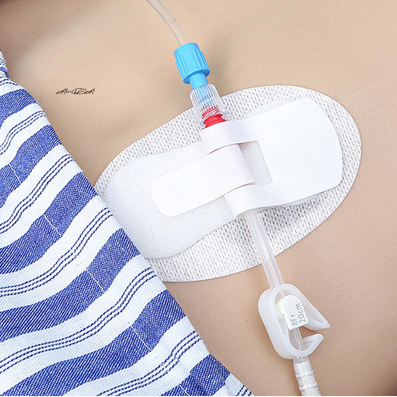 Adhesive Urinary Catheter Holder Leg Band G-Anchors Stabilization Device for Nephrostomy Tube Fixing - Bag Strap Leg Band