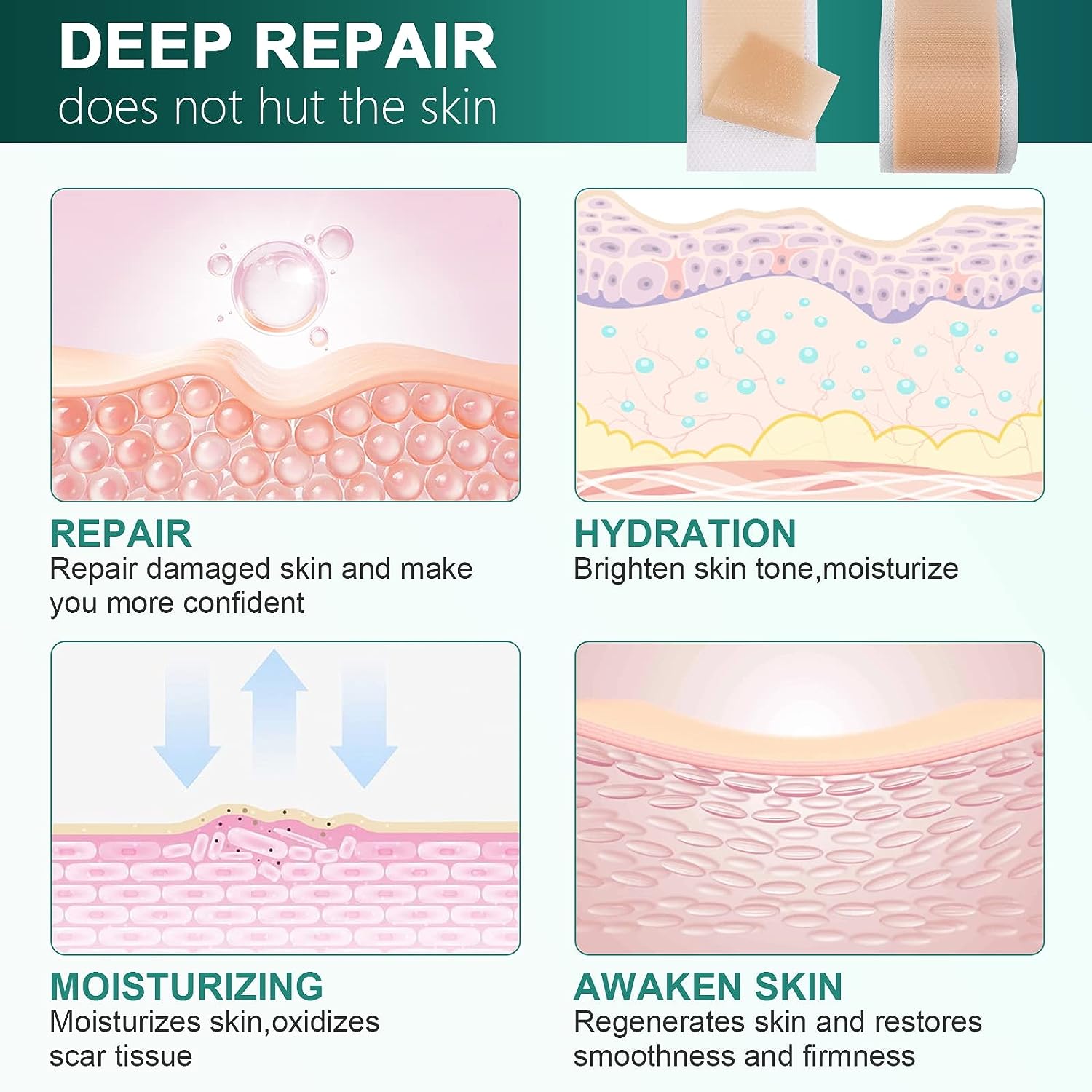 1 шт. 150 см силиконовый гелевый пластырь для лечения шрамов лента для удаления акне — фото 5