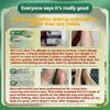 Urticaria ointment anti-allergic and anti-itching cream