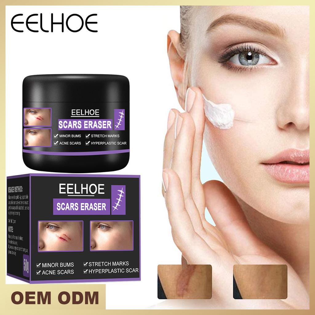 EELHOE Scar Removal Cream Gel Remove Acne Spots Treatment Stretch Marks Burn Surgical Scar Repair Cream Smoothing Whitening Skin Beauty 50g