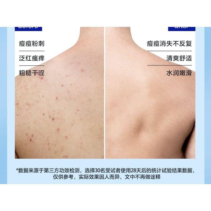 Z:SEA - Water Fruit Acid Acne Removing Shower Gel
