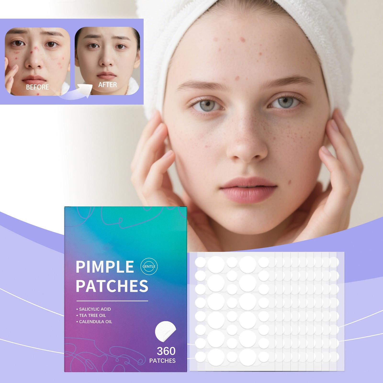 

The Facial Acne Patch Can Fade Acne And Blackheads, Close The Openings And Improve Acne-prone Skin. It Is Gentle And Suitable For Daily Care. One Size фиолетовый