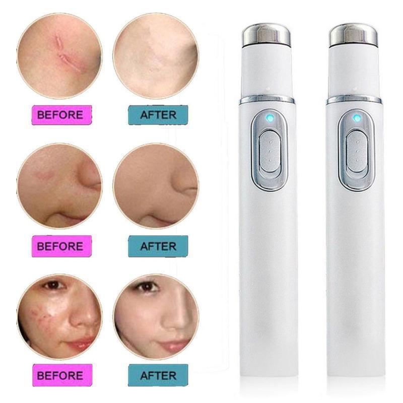 Blue Light Therapy Acne Laser Pen Led Face Light Therapy For Scar Wrinkle Removal Treatment Device Skin Care Beauty Equipment