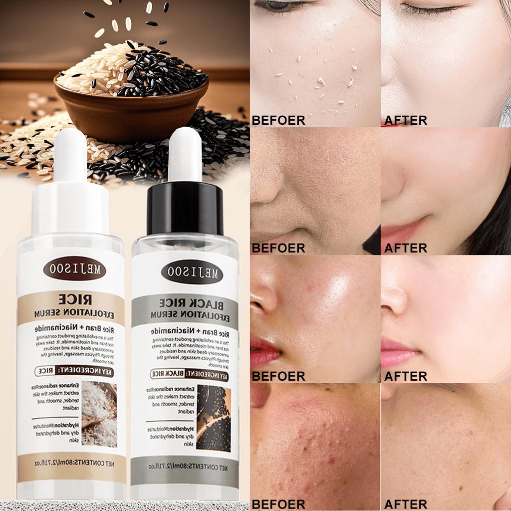 1 Stück Reis Peeling Essenz Feuchtigkeitsspendendes Gesichtsserum Zarte Haut Zart Glänzend Intensive Hydratation Glatte Textur