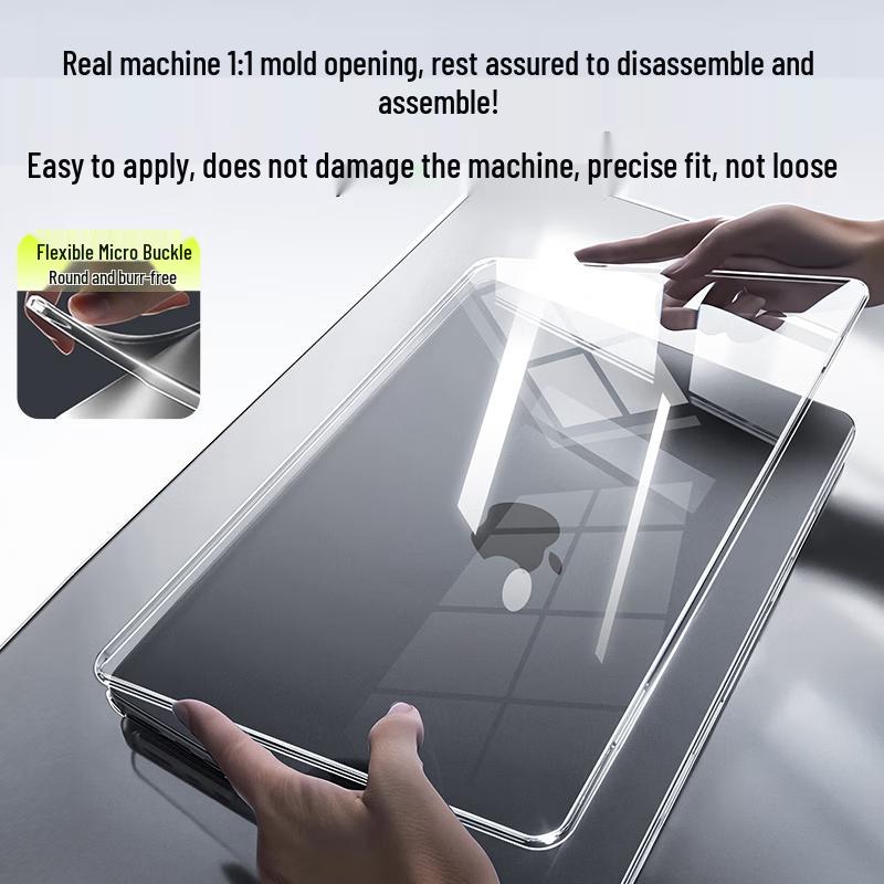 Suoying Ultra-Thin 0.8mm MacBook Protective Case