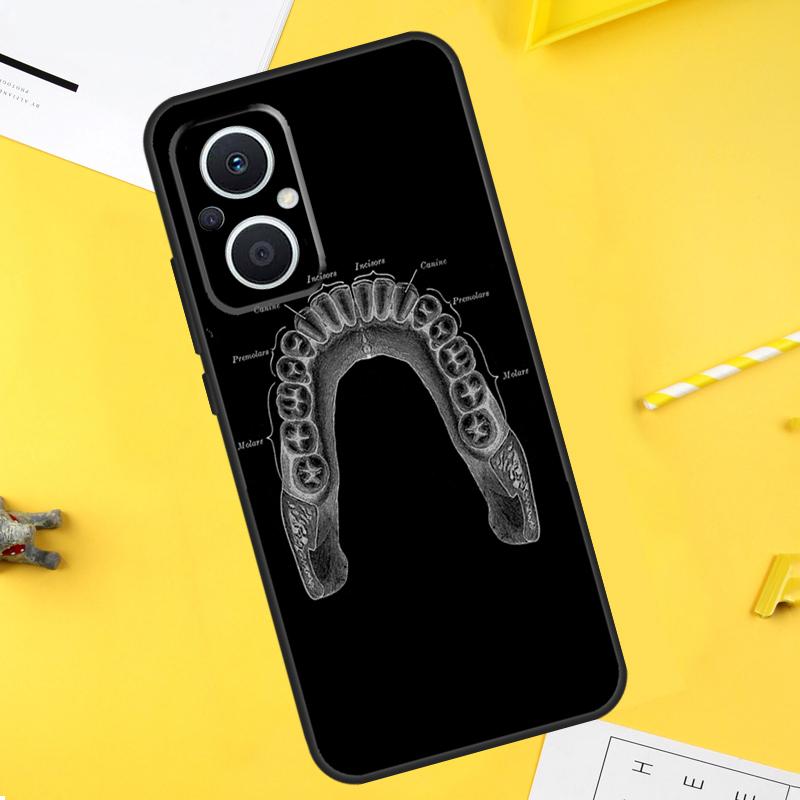 The Dentist Tooth Case For OPPO Reno 7 Reno 10 Pro 4 5 6 8 Lite 8T 4Z 5Z OPPO Find X6 X5 Pro X2 X3 Neo Cover