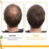EELHOE Biotin Hair Care Essential Oil Deeply Moisturizes Hair with Scalp Massage Care, Supple and Shiny Daily Hair Care Products 30ml