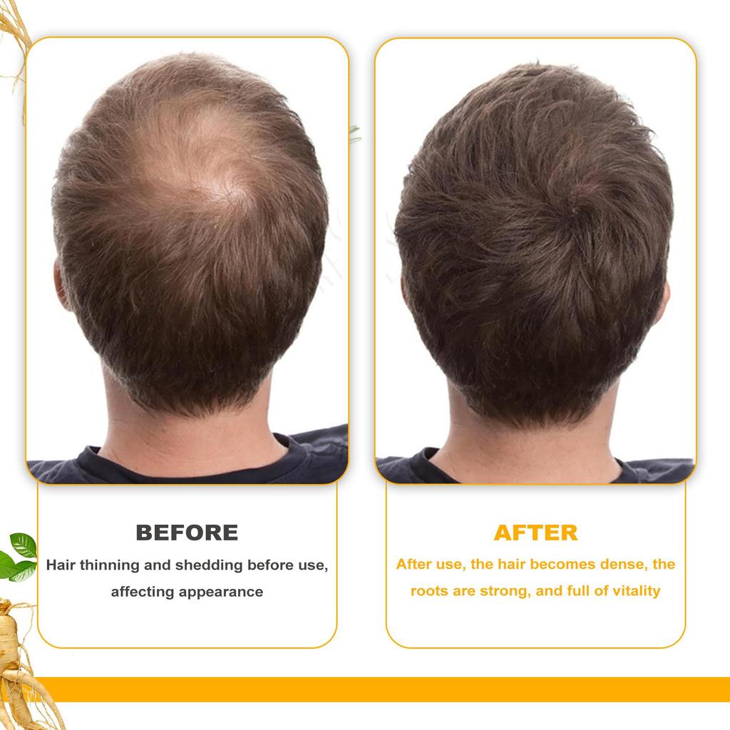 EELHOE Biotin Hair Care Essential Oil Deeply Moisturizes Hair with Scalp Massage Care, Supple and Shiny Daily Hair Care Products 30ml