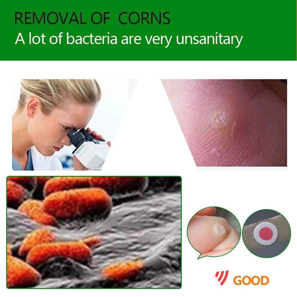 Foot Corn Removal Killer Foot Protection Pain Relief Curative Plaster Medical Sticker Corns Plaster