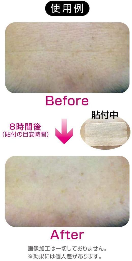 Para rosto pacote de valor de fita facial de 200 cuidado "Folhas antirrugas"