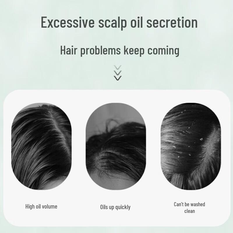 Shilang Anti-Hair Loss & Growth Shampoo