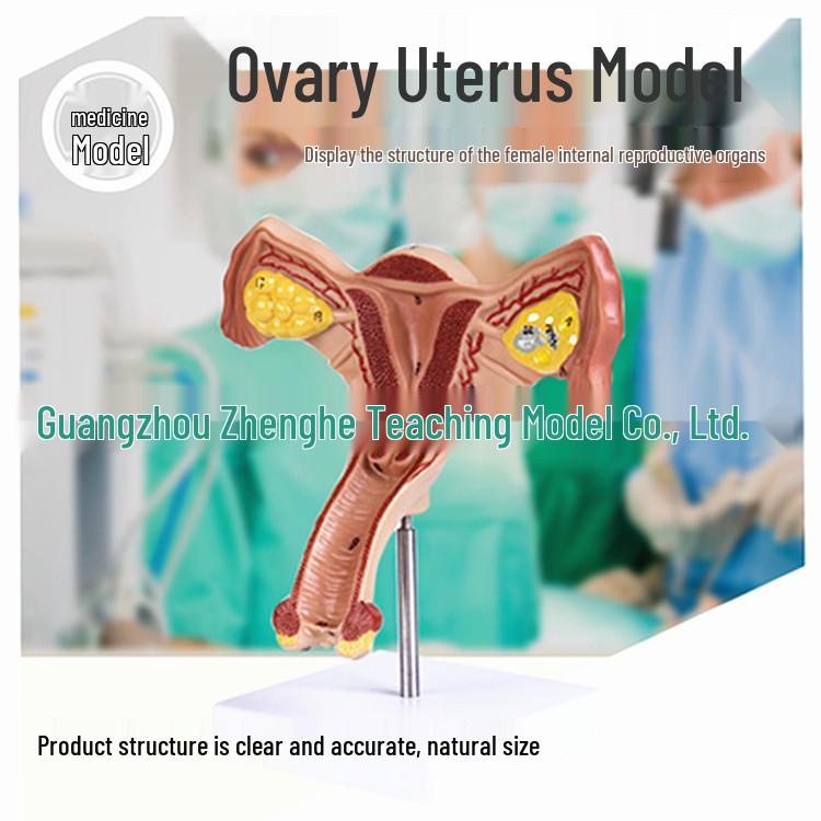Female Pathology Uterus Model for Obstetrics & Gynecology Education 20x19.5x11 cm