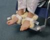 Produits orthopédiques – Produits orthopédiques pour les pieds