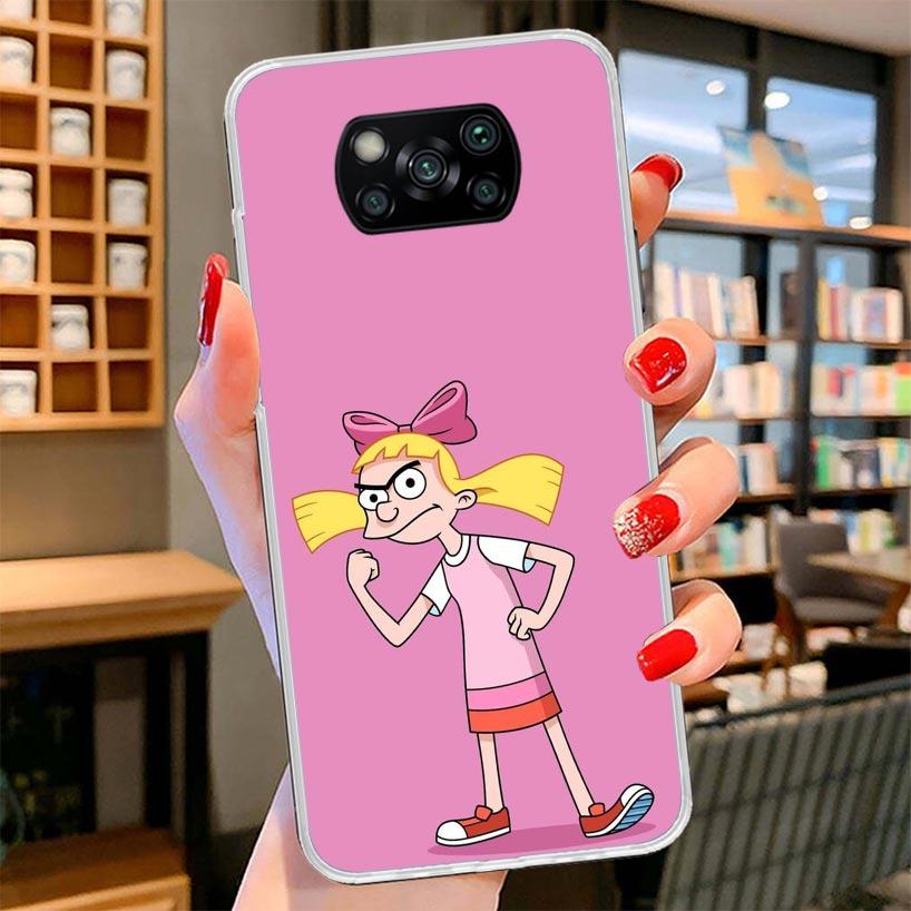 Cartoon Hey Arnold Fondos Cover Phone Case For Xiaomi Poco F7 Ultra X7 X6 X5 Pro M7 Redmi 15C 15 13C 13 12C 12 10C 10 9A 9C 9T 9
