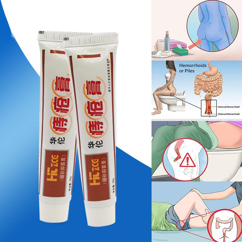 Hemorrhoid Ointment Hemorrhoid Care Cream Ointment For Male And Female Internal And External