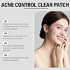 SOUTH MOON Face Acne Patch Invisible Pimple Patch Isolate Dust Prevent Picking No Makeup Caking Blemish Care