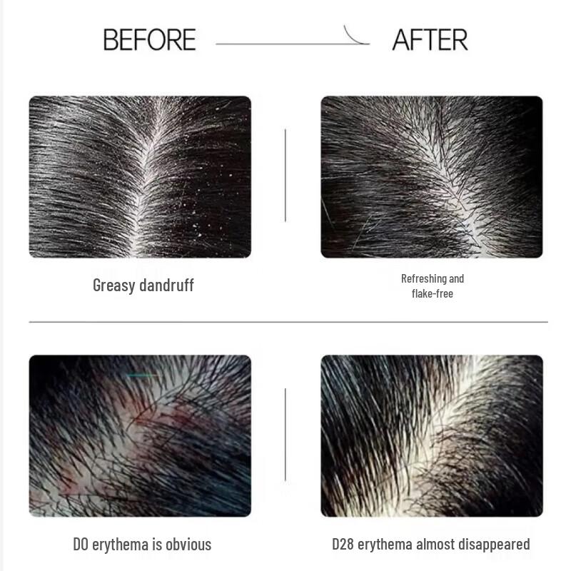 Spes Myrrh Peptide Anti-Dandruff Volumizing Shampoo