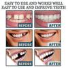 Adjustable Snap-On Denture Set 1-3pcs - Temporary Tooth Modification for Gap Filling and Cosmetic Dental Solution