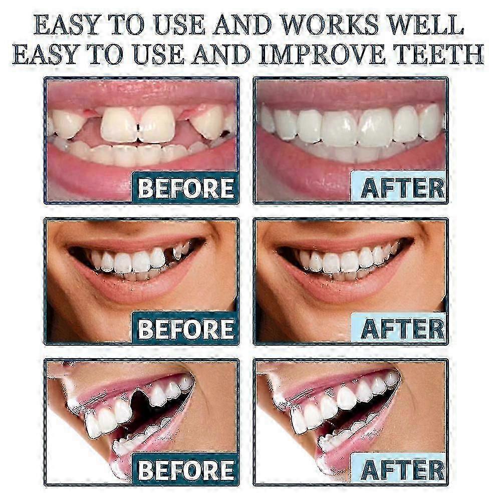 Adjustable Snap-On Denture Set 1-3pcs - Temporary Tooth Modification for Gap Filling and Cosmetic Dental Solution