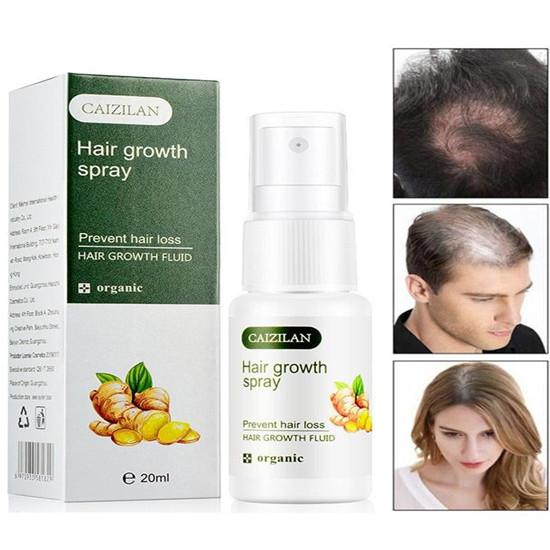 

Спрей для роста волос с имбирем, сыворотка, натуральные продукты против выпадения волос, быстрорастущие средства для предотвращения облысения, зародышевая жидкость для мужчин и женщин, 20 мл