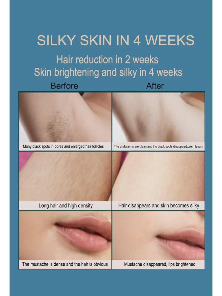 Tragbares Hand-IPL-Haarentfernungsgerät für Männer und Frauen – Ideal für Achsel- und Beinhaare