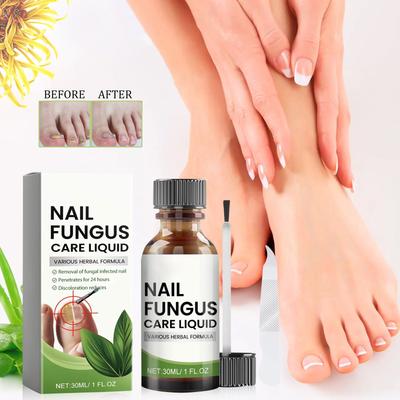Toenail TreatmentExtra Strong, NailTreatment, Nail TreatmentExtra Strong For Thick, Discolored And Damaged Nails,30ml