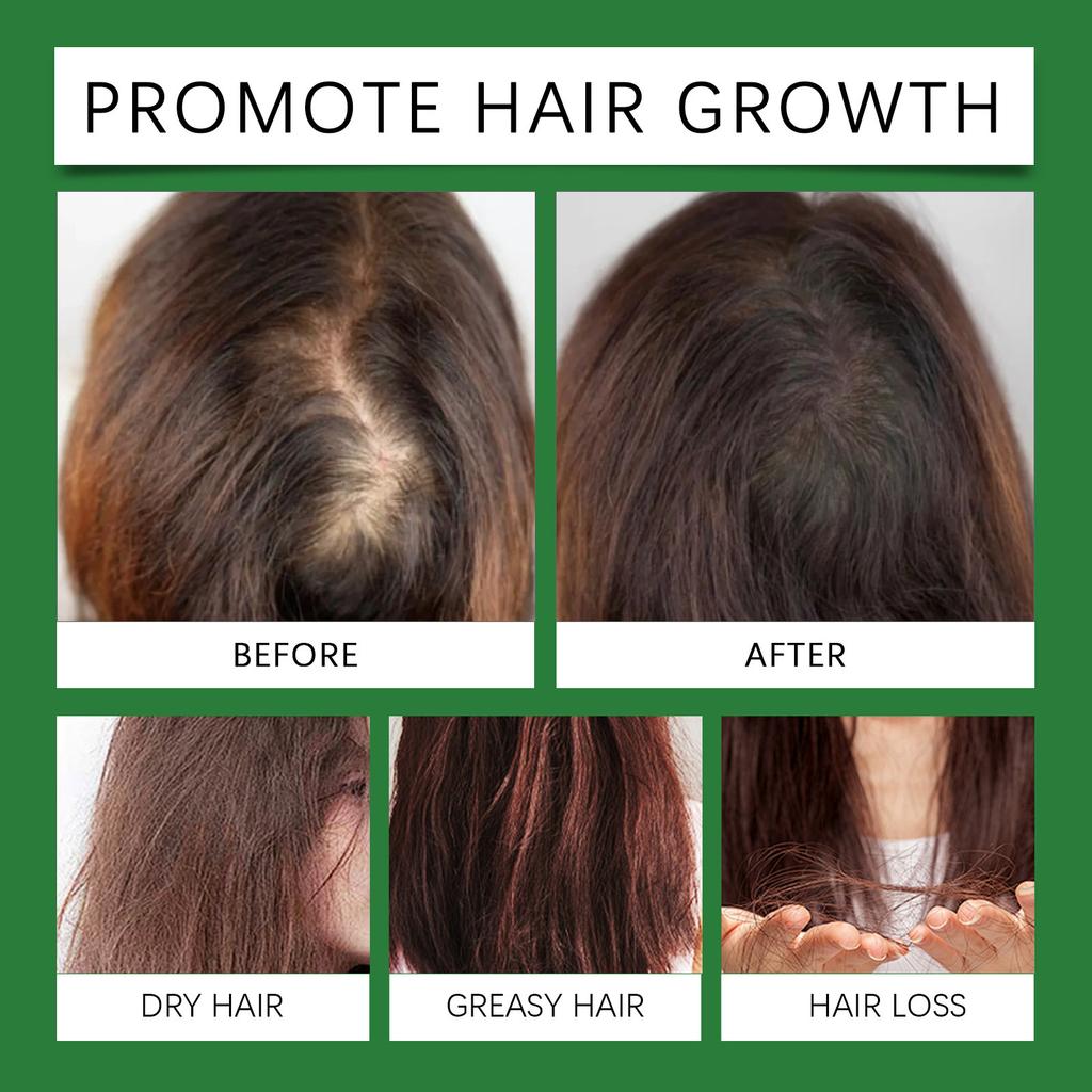 Lightweight Hair Oil Strengthens Hair, Reduces Hair Loss, And Contains Low Allergenic Ingredients That Are Lightweight ,50ML