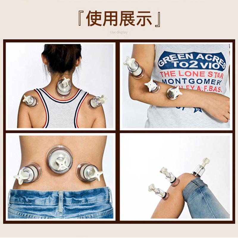 SHARE HO 5 Storlek ABS Vakuumkoppar Burkar Handvridna Anti-cellulit Massagekoppar Roterande Sugkopp Kinesisk Terapi Hälsovård