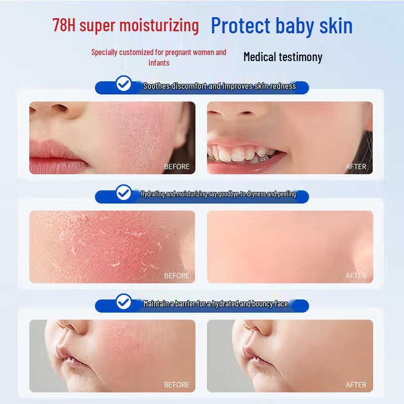 FIVERAMS Gentle Hydrating Cream for Children & Teens