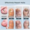 Nail Fungus Laser Treatment Device for Multiple Toenail, Home Use 905nm Infrared Light + 470nm Blue Light Toe Nail