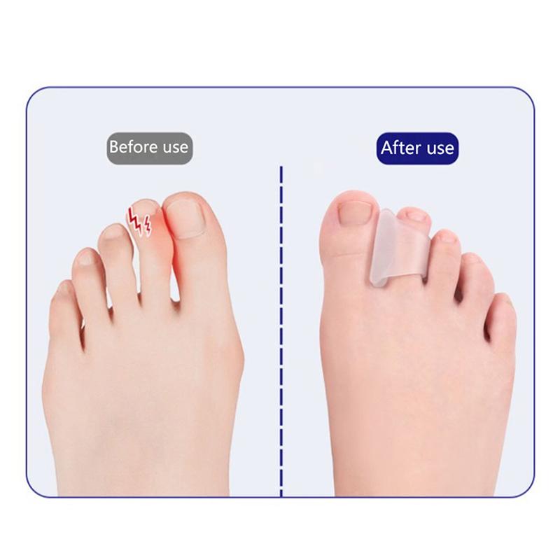 1Pair Soft Silicone Toe Separator Treat Hallux Valgus Bunion Foot Overlapping Corrector Anti-Wear Care Pads Pedicure Tools