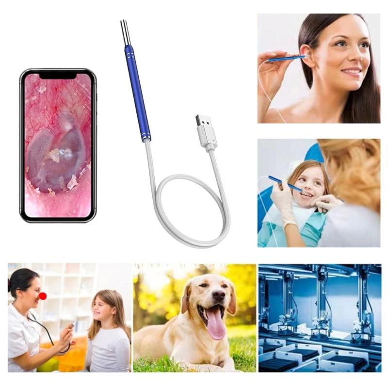 Ear Wax Remover Earwax Remover Tool Ear Camera Ear Otoscope with 6 LED Light Ear Scope with Ear Wax Cleaner Tool