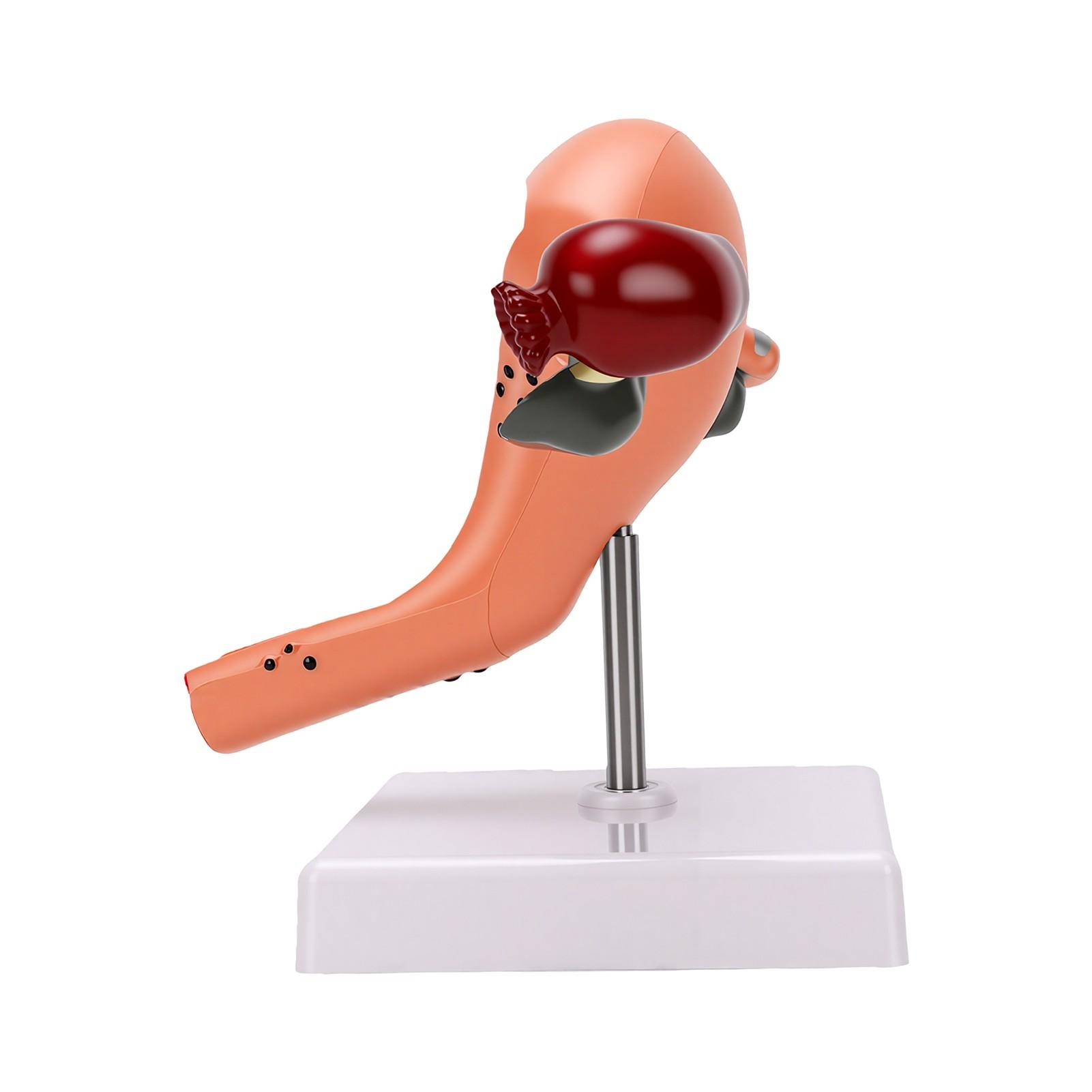 Female Pathological Uterus Ovary Anatomical Model Human Uterus Anatomy Model for Education Study Teaching
