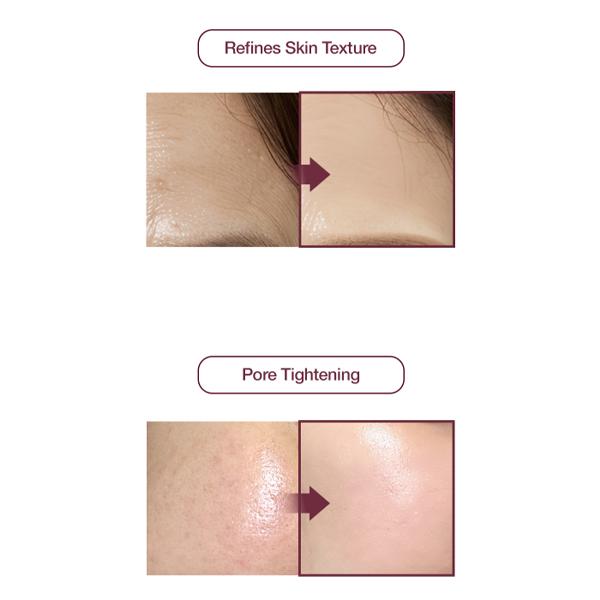KI Cosmetics Stem-Cell Exosome Skin Booster Kit (30ml / 6ml × 5 Kits) (3 Options)