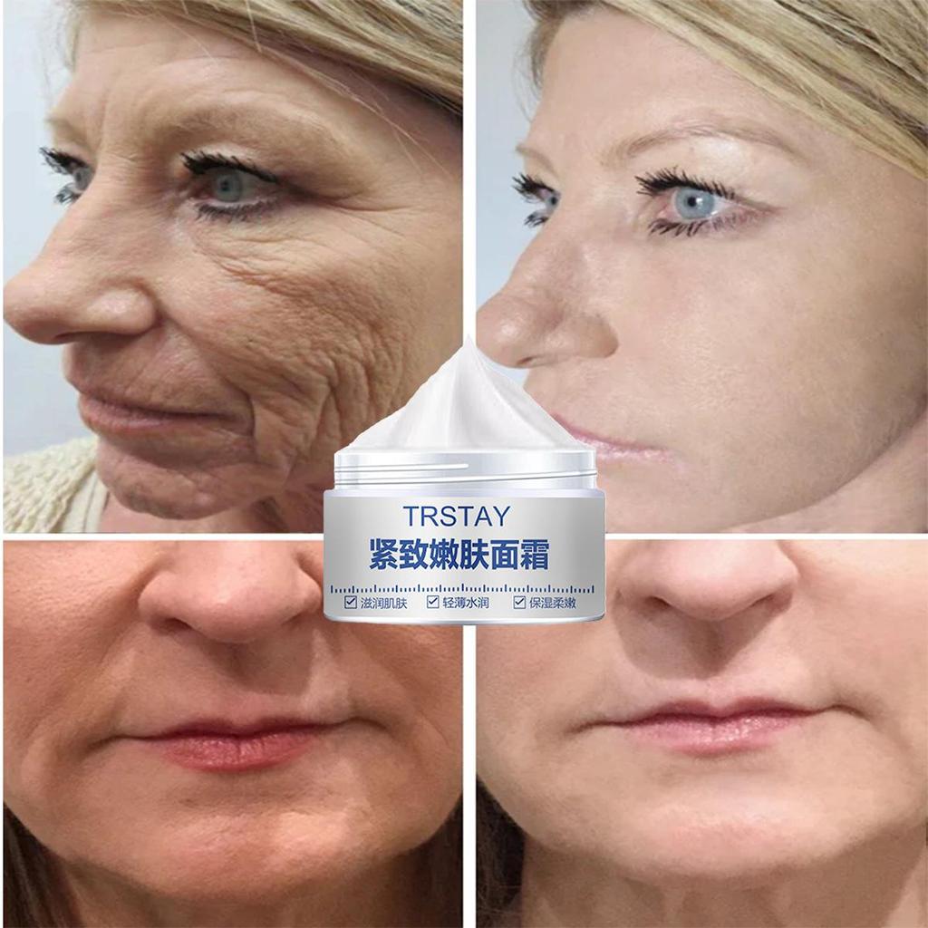 TRSTAY Moisturizing Cream, Vitamin C Brightening Face Cream, Brightening Skin And Lightening Spots