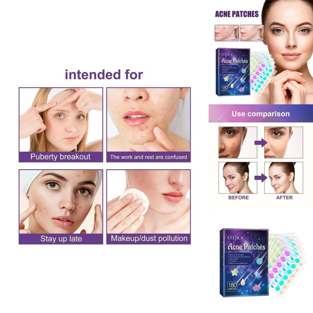 Eelhoe Pimple Patches For Effective Skin Repair And Acne Spot Treatment With 180 Pieces For Clear Complexion