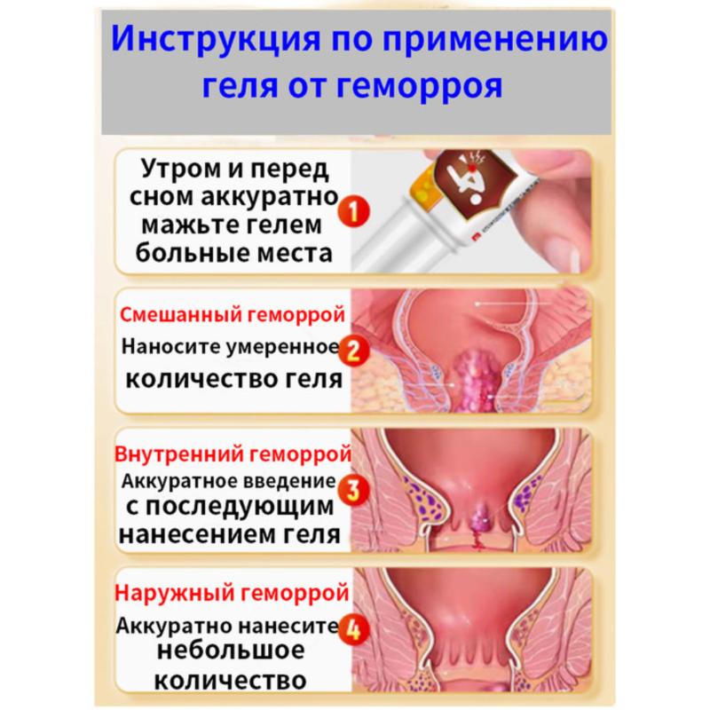 Chinese Hemorrhoid Ointment for Piles and Fissures, 20 Ml