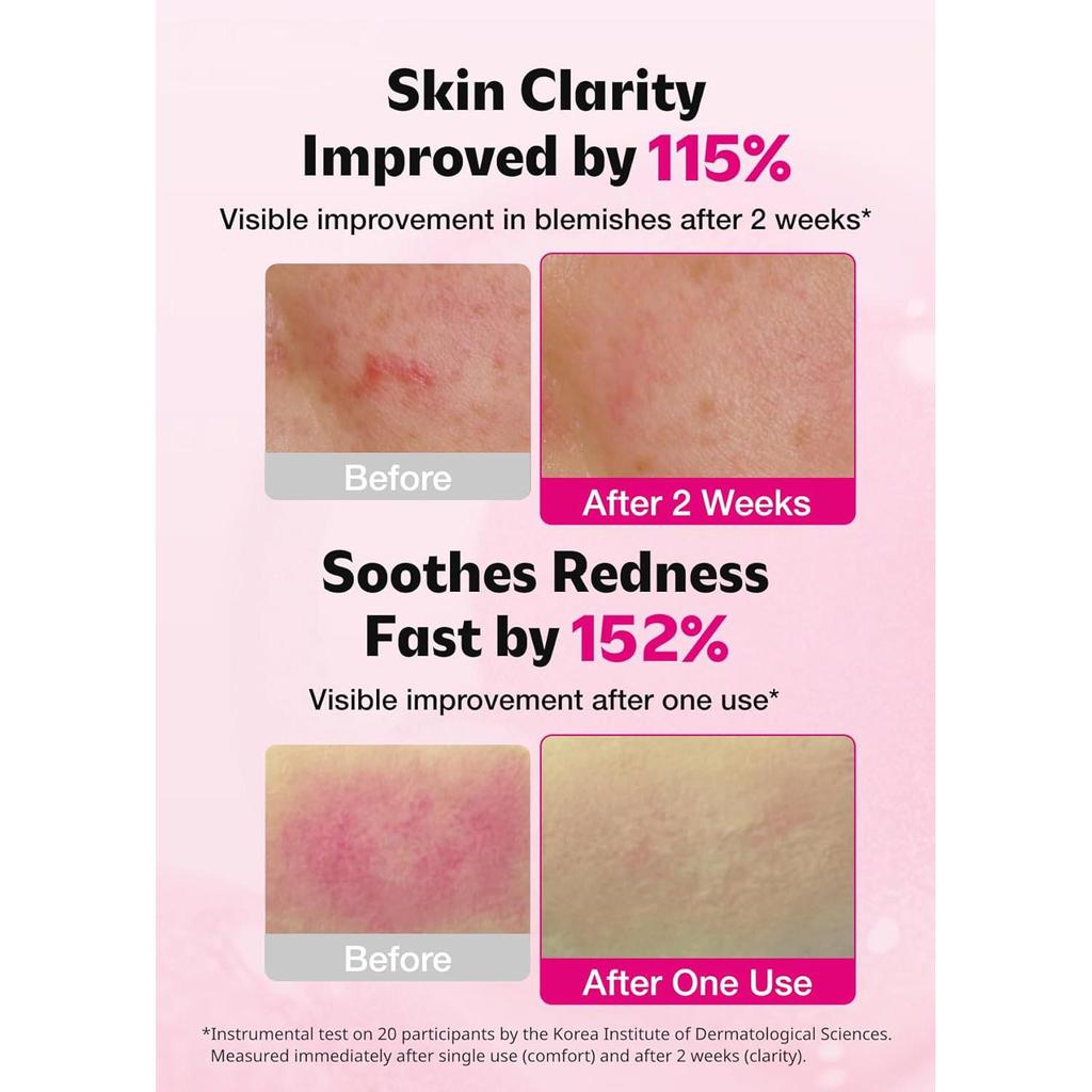 isoi Blemish Care Up Serum 50ml – Brightening, Hydrating & Dark Spot Care with Vitamin Tree, Korean