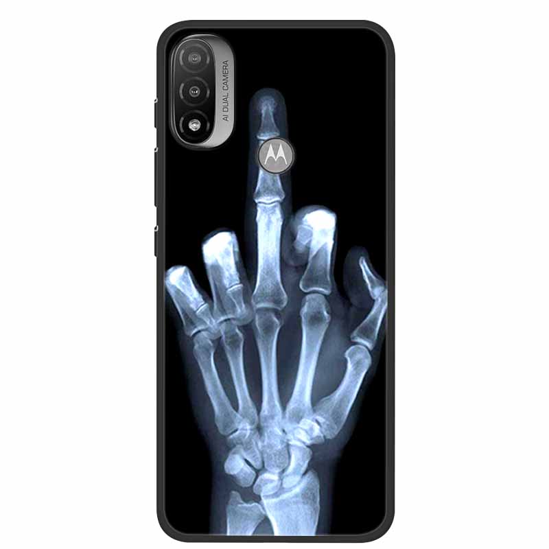 For Moto E20 Case Shockproof Soft Silicone Back Cover For Motorola Moto E20 6.5" Phone Cases For Moto E 20 XT2155 Coque Fundas
