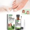 Conjunto Avançado Ximonth para Reparação de Unhas dos Pés e das Mãos para Cuidado de Unhas Saudáveis e Bonitas