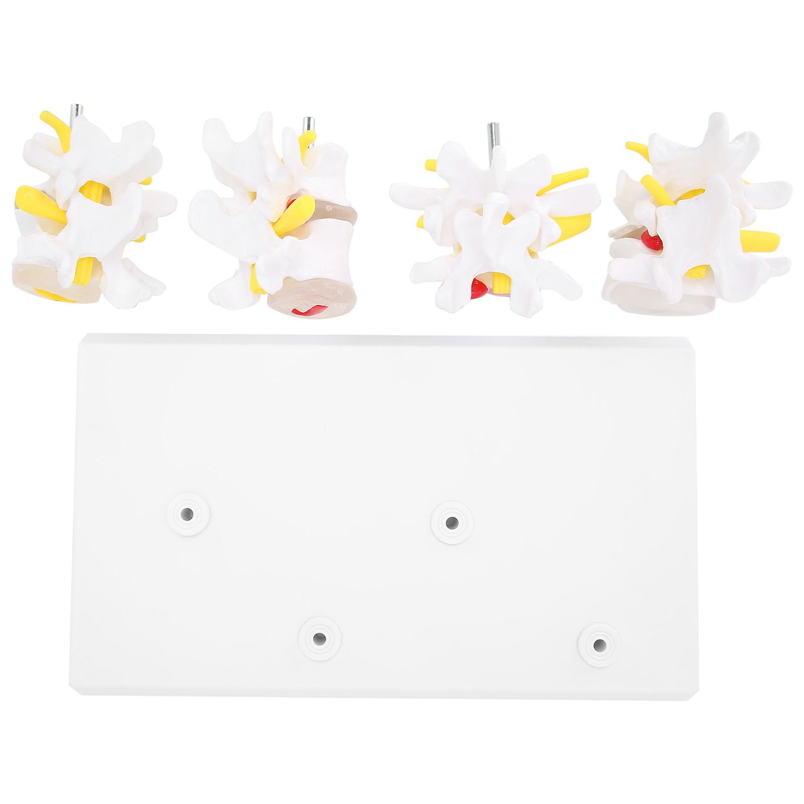 

4-ступенчатая модель позвоночника человека. Нормальные и патологические модели поясничных позвонков с основанием