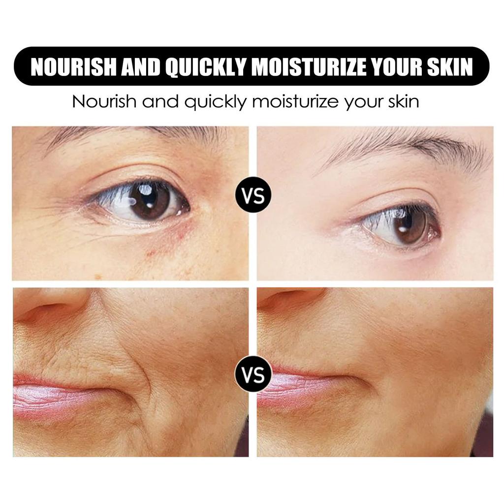 Wrinkle Remover Cream Firming Lift Anti-aging Fade Forehead Fine Line Rejuvenation Brightening Hydrating Whitening Freckle Cream