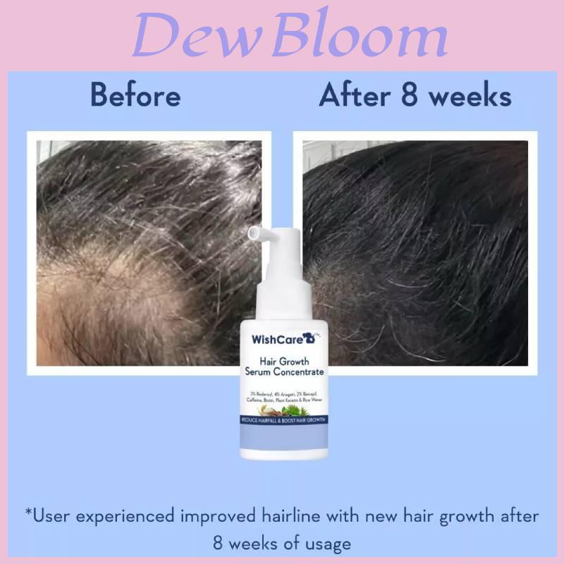B3014 Hair Growth Concentrate Serum For Home Use With Luxurious Packaging For All Hair Types