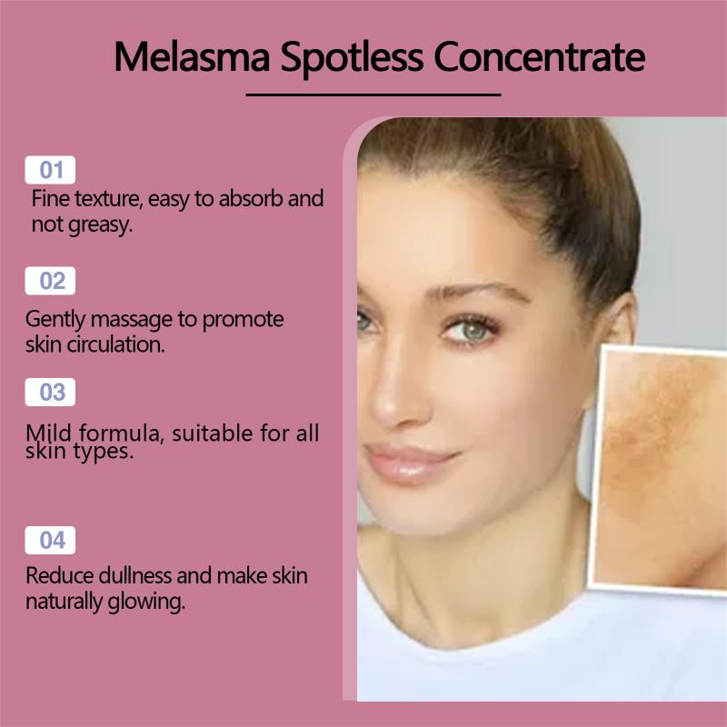 Powerful Spot-Removing Whiten Cream Brighten Skin Fast Eliminates Melanin Pigmentation Melasma Dark Spots