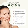 Vedcare Acne Pimple Patch for Face (72 dots) | Waterproof Patches for Active Acne | Absorbs Pimple Overnight, Reduces Excess Oil | Facial Patches