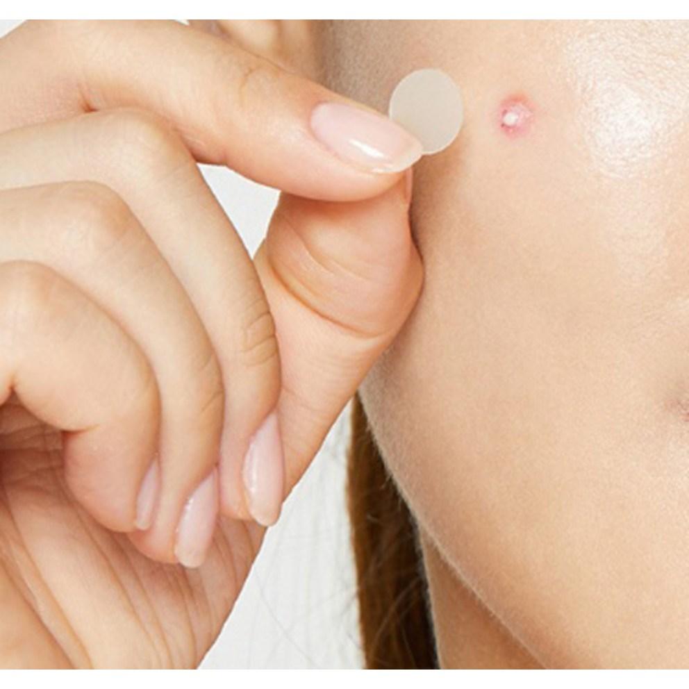 COSRX Acne Pimple Master Patch, 24 patches, 2ea